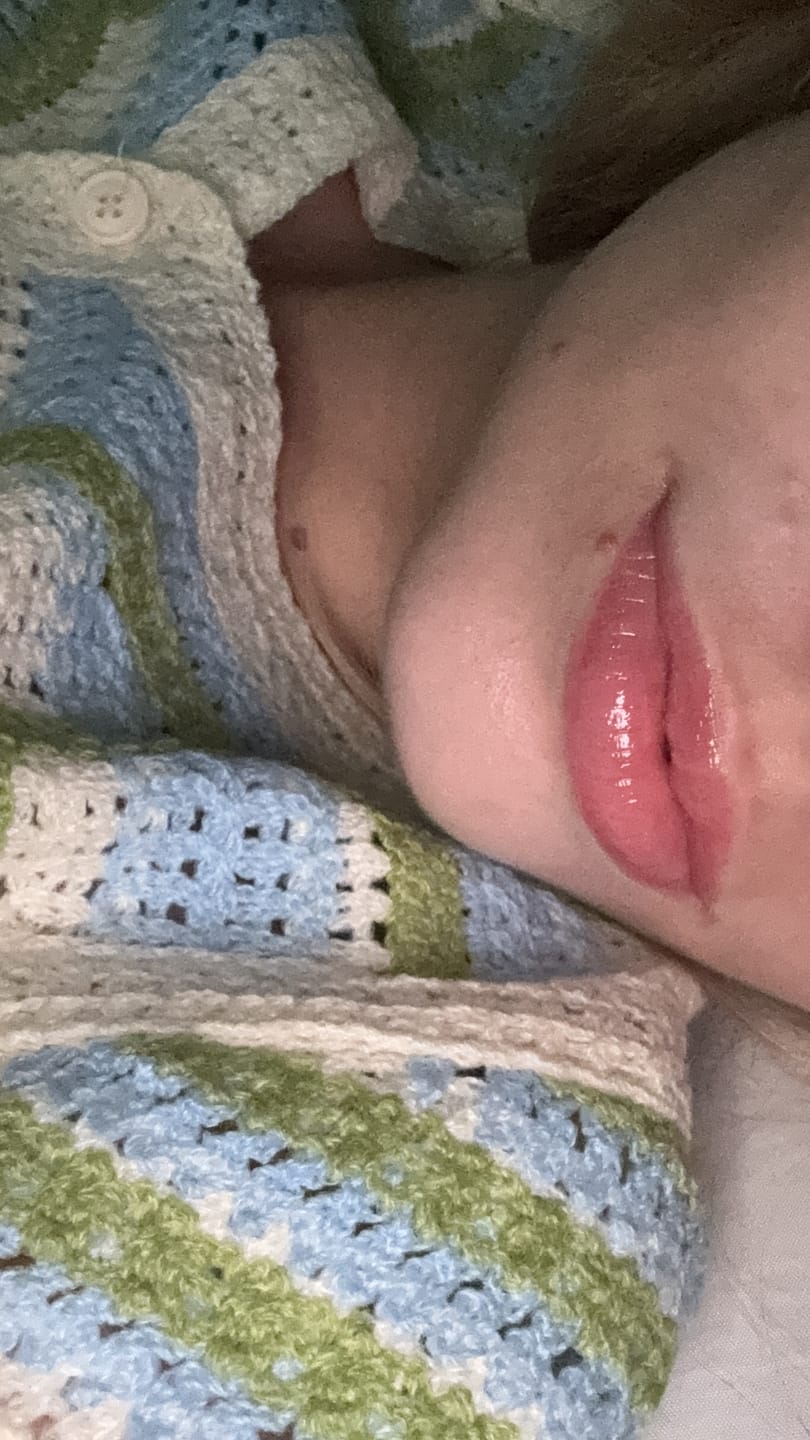 Customer photo review of PEPTIDE LIP BALM