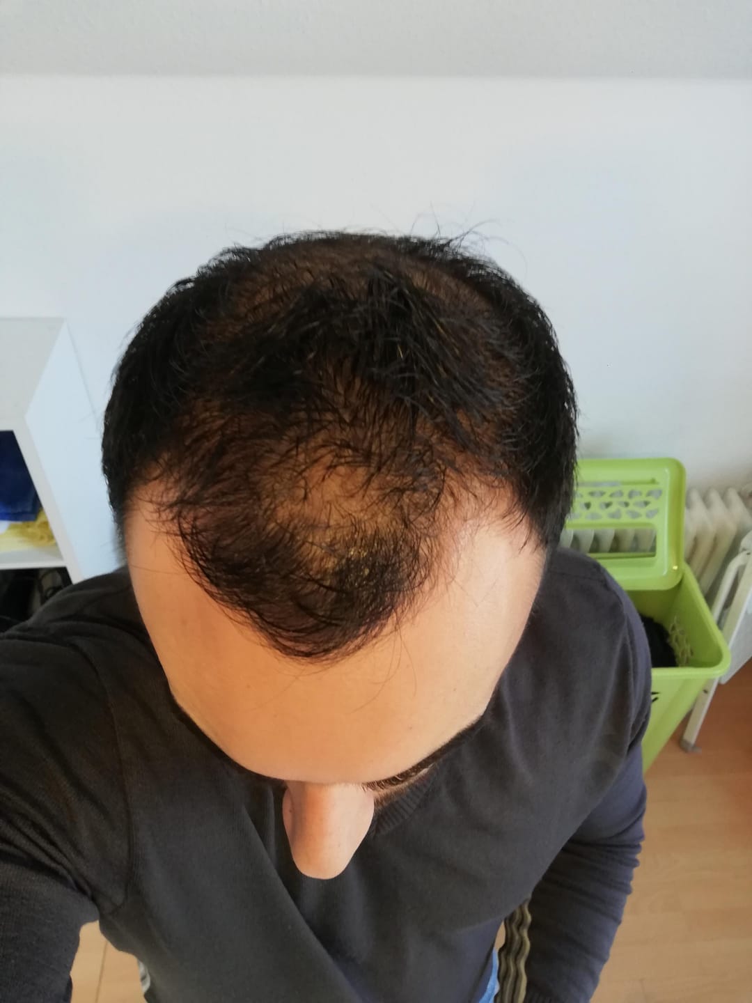 Customer photo review of Fibre Per Capelli COTTONFIX 28 gr.
