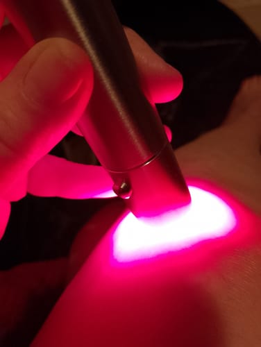 Vásárló használja a készüléket a bőrén, amely erős, piros fénnyel világít.