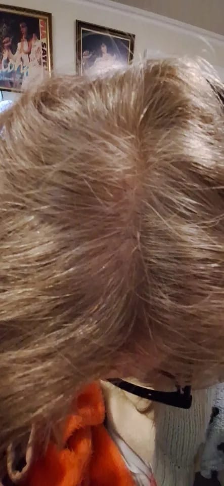 Customer photo review of HAIR RICH | BRENG JE HAAR WEER TOT LEVEN!