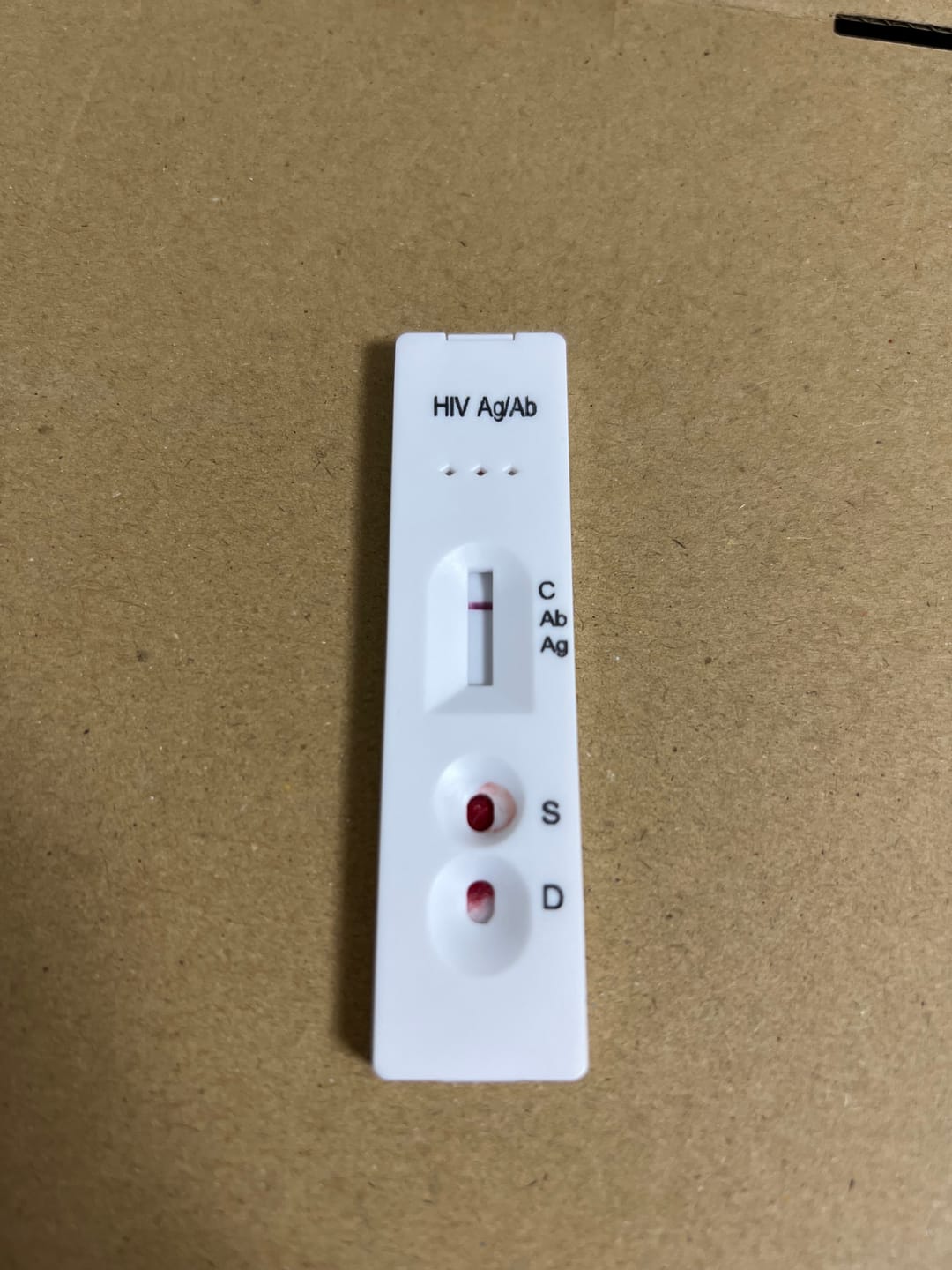 Customer photo review of STD自宅検査｜HIV(エイズ) 検査キット