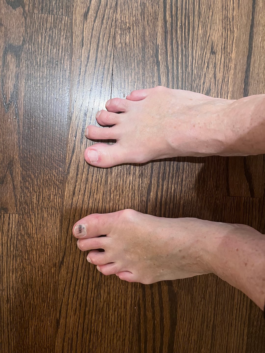 Customer photo review of Death Begins in Your Big Toe Masterclass
