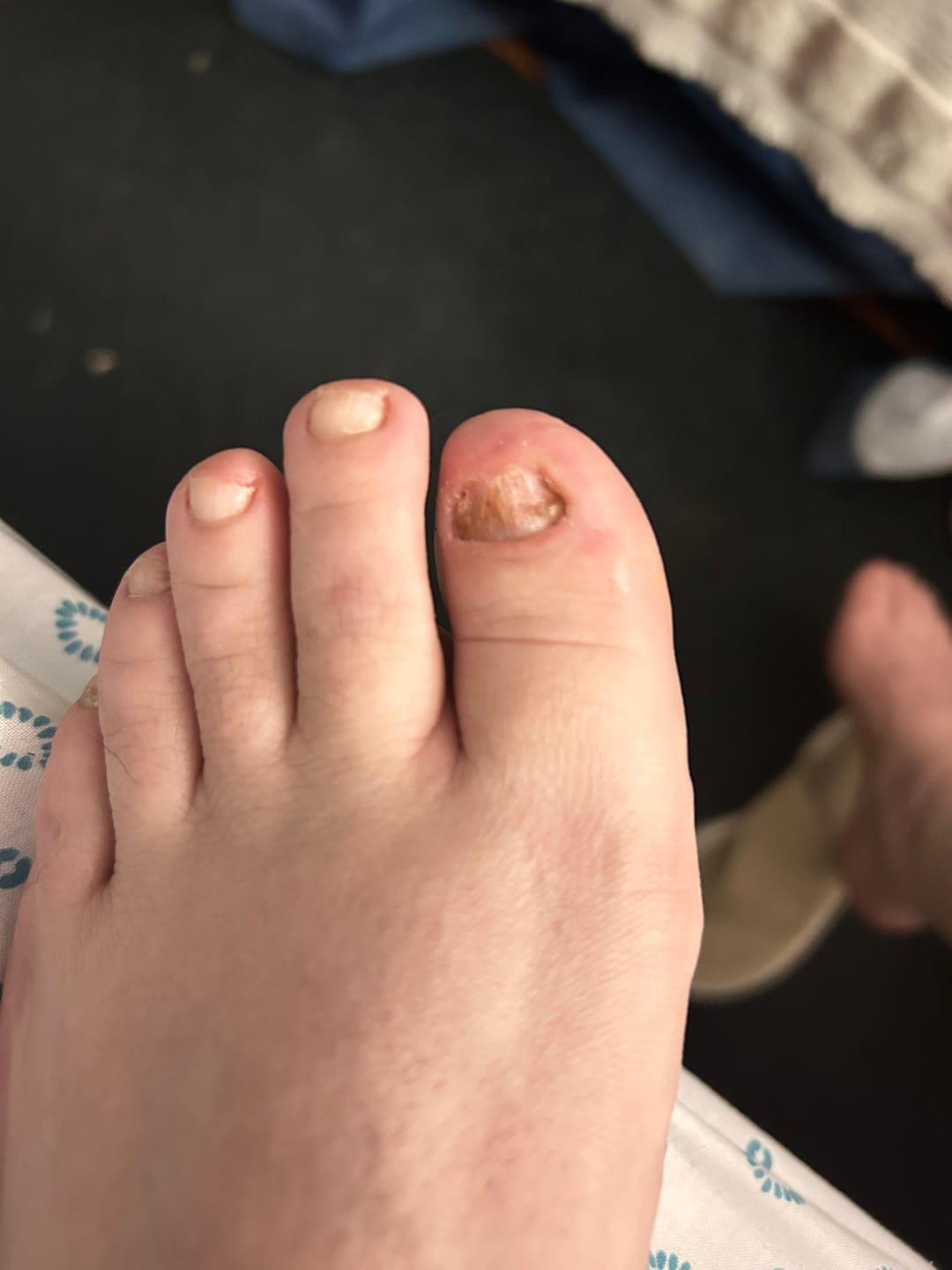 Customer photo review of Kit ByeBye Hongos – Uñas Sanas & Cuidadas