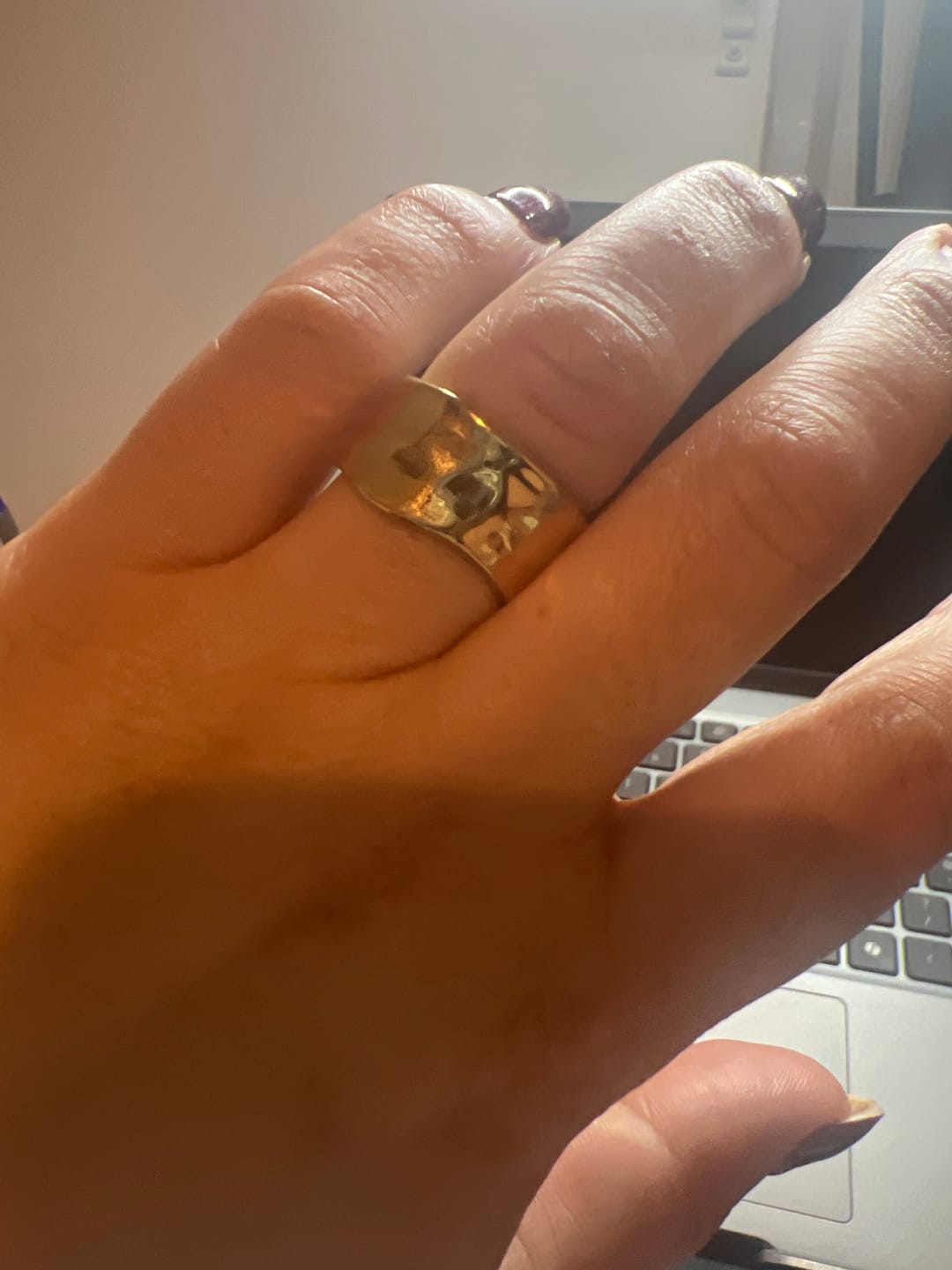 Customer photo review of Textured Band Ring