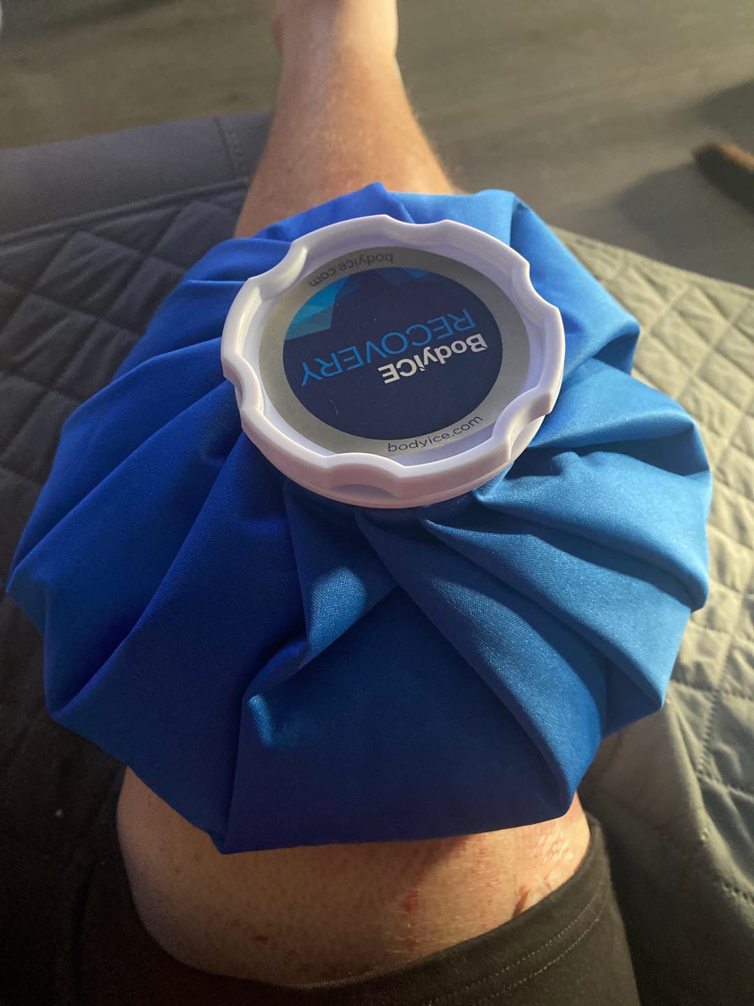 Customer photo review of 11 Inch Ice Bag Duo