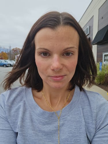 Customer photo review of WrinkleFix: Unlimited Toxins Membership Auto renew