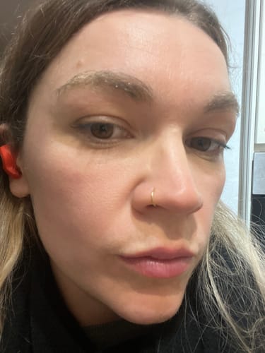 Customer photo review of Seb Natural Calming Serum