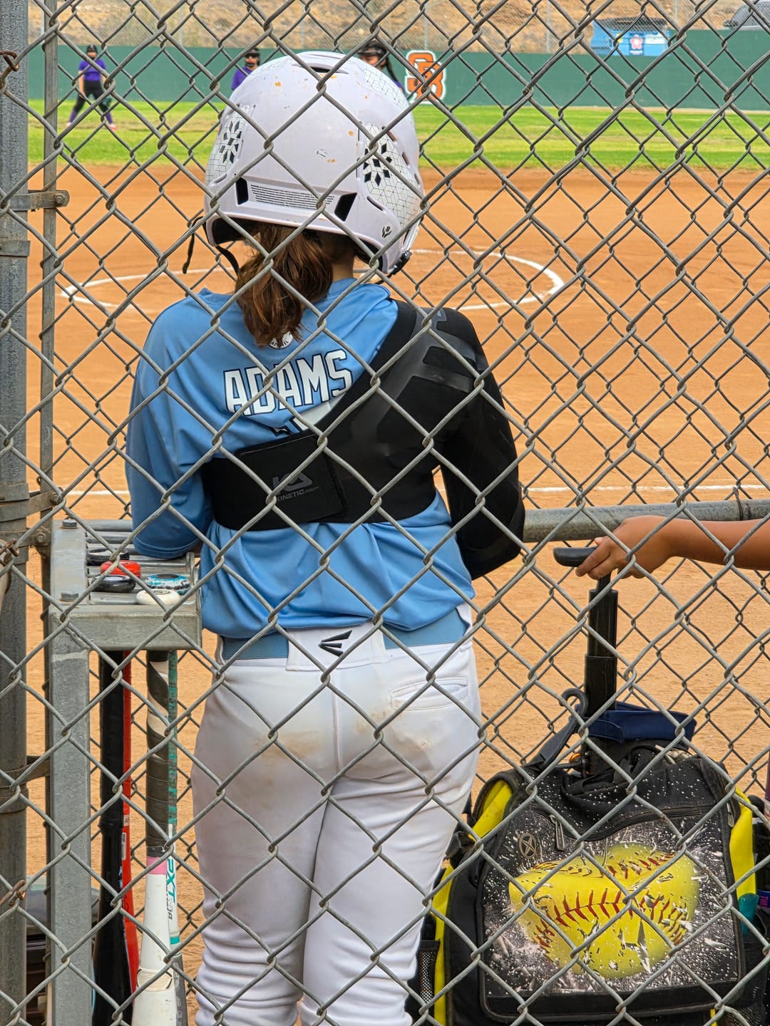 Customer photo review of Dynamic Shoulder & Elbow Stabilizer - K2 Youth Sleeve