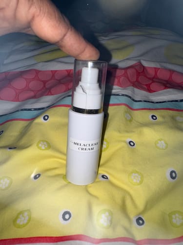 Customer photo review of MELACLEAR CREAM ( PRÉ COMMANDE )