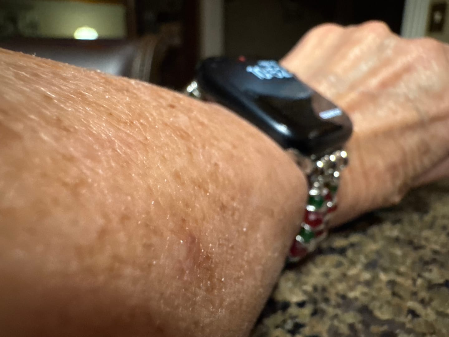 Customer photo review of Christmas Charm Stretch Apple Watch Strap