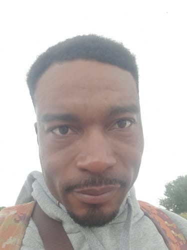 Customer photo review of Minoxidil High Strength (5%) FOAM, 3x60ml pack