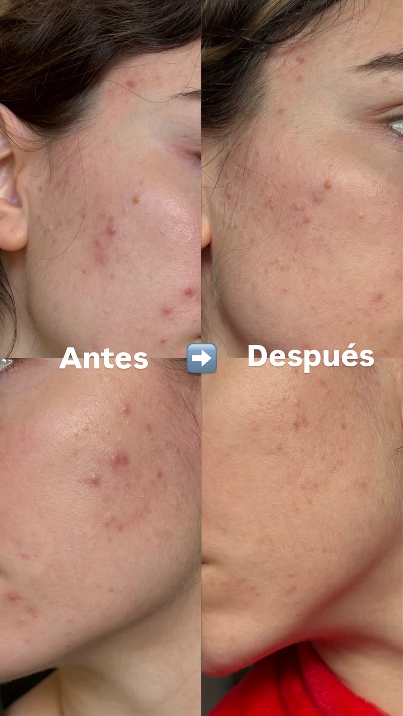 Customer photo review of A CONTROL + CORTIZEN - Equilibrio hormonal desde el cerebro, los ovarios, la piel y el metabolismo.