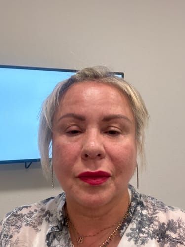 Customer photo review of Liftlab Sculpting Serum