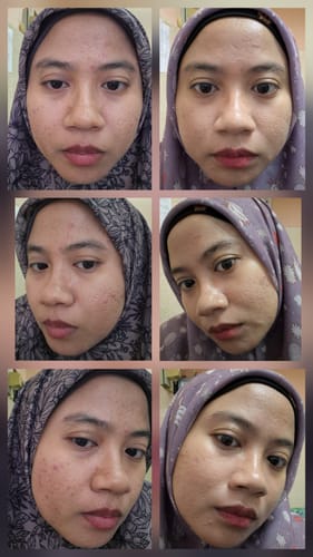 Customer's before-and-after photos showing less redness and smoother skin after using the Triple Action Serum.