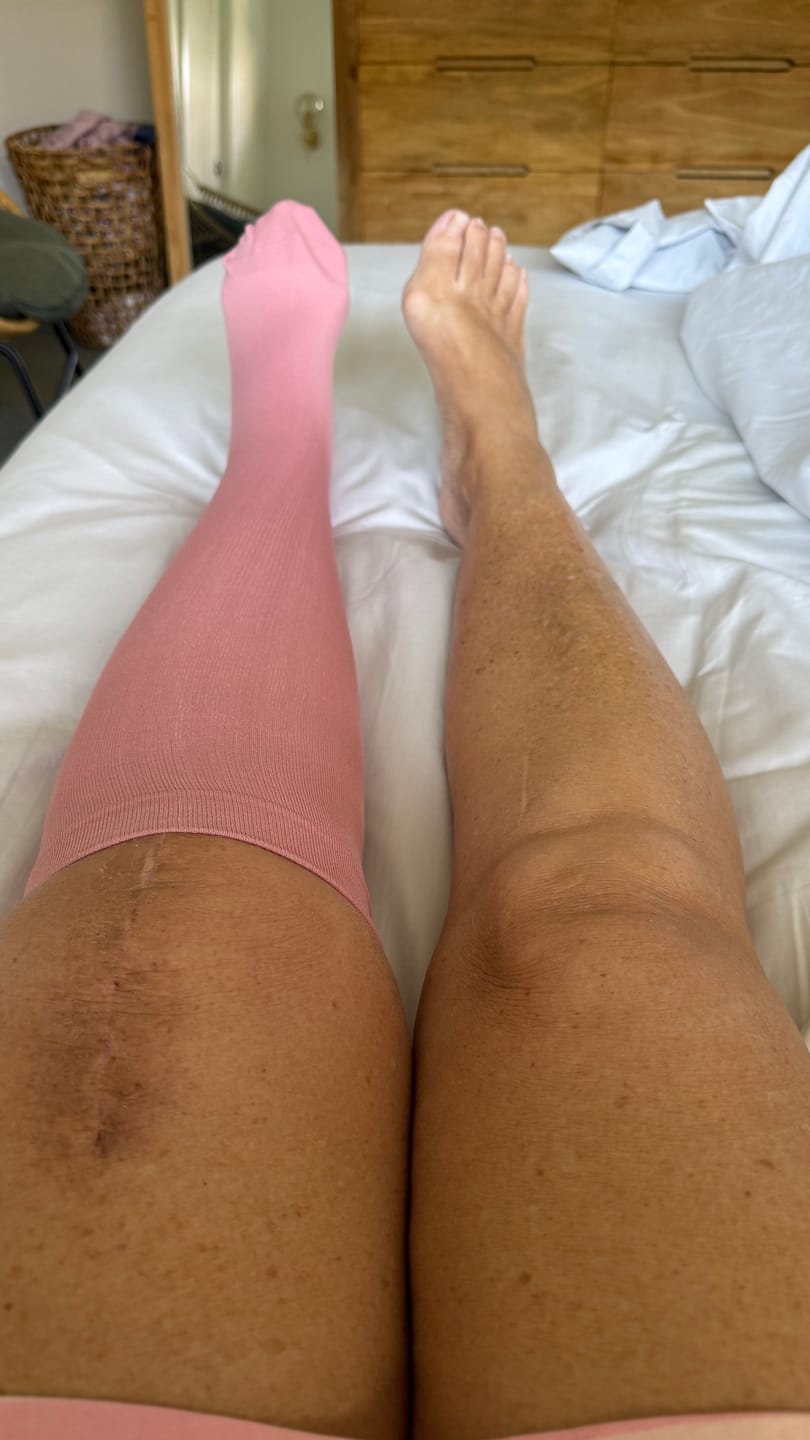 Customer photo review of Everstride™ Original Wide Compression Socks