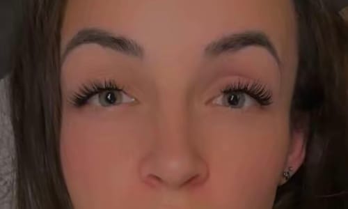 Nahaufnahme der Augen einer Kundin, die das LASH BABY STARTER KIT für lange, volle Wimpern verwendet.