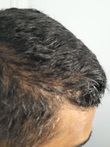 Customer photo review of Seb Natural Calming Serum
