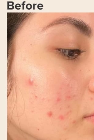 Customer photo review of Skin Rescue Mist