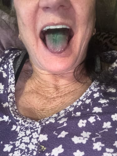 Customer photo review of BetterLungs®