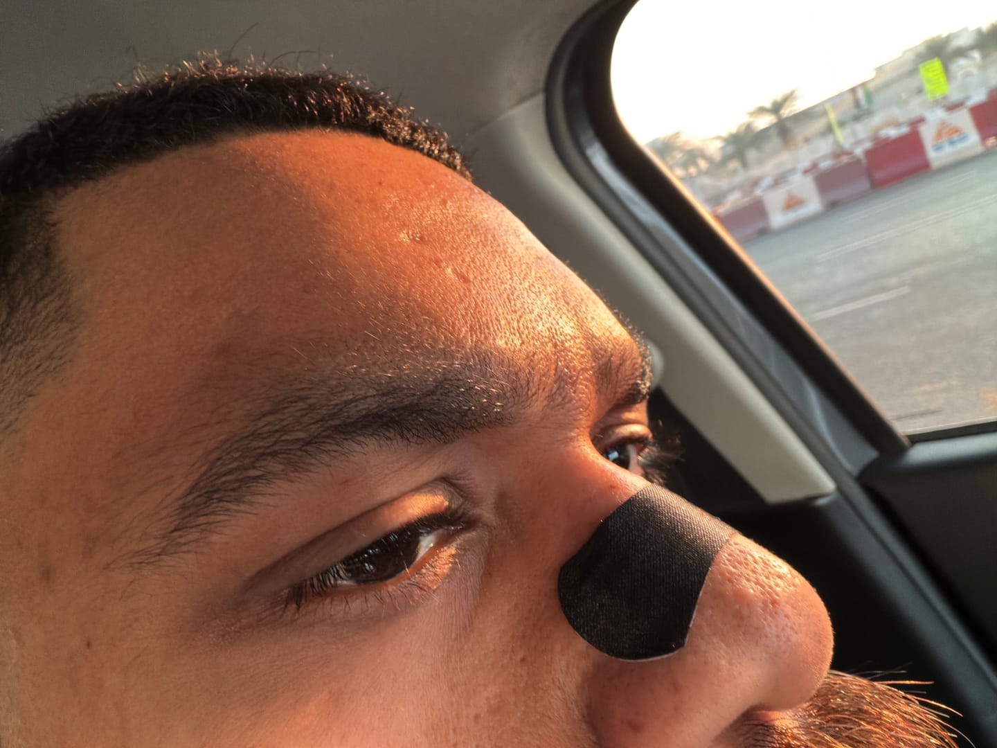 Customer photo review of Black Nasal Stride