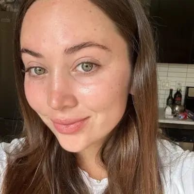 Customer photo review of Serum Ultra Reparador con 3% de Ácido Hialurónico de LV Camps (30 Ampollas)