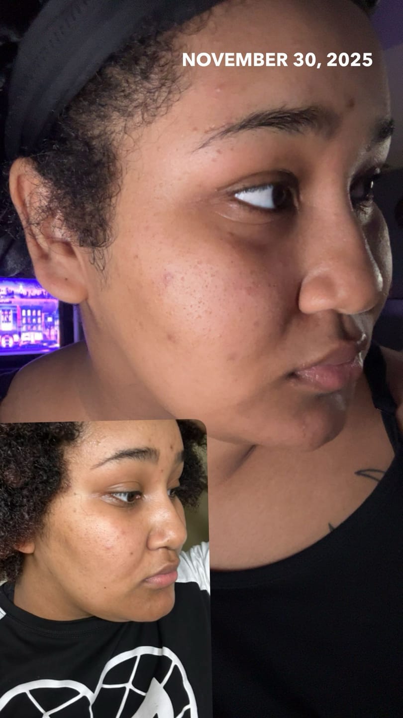 Customer photo review of Melanin Skin Bundle