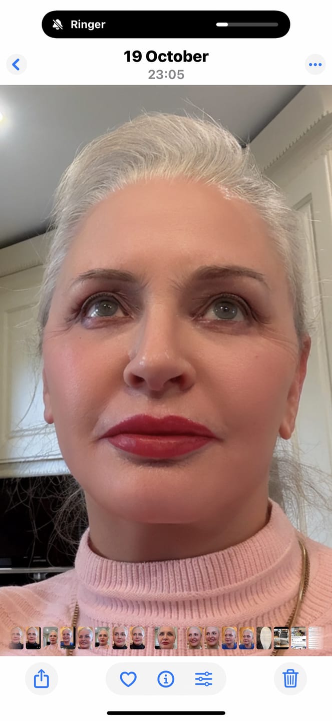 Customer photo review of VEAUTY Dot & Aqualis Activator