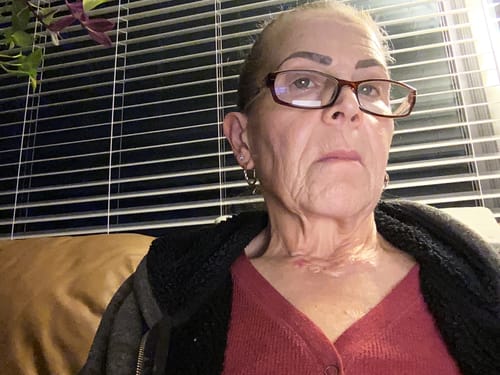 Customer shows her face and neck. Her review mentions using the Grass Fed Tallow & Honey Balm daily.