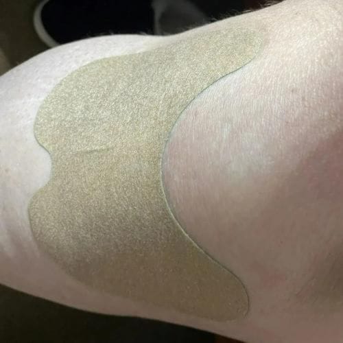 Customer photo review of Parches Naturales para Dolor de Rodillas Aliviate™