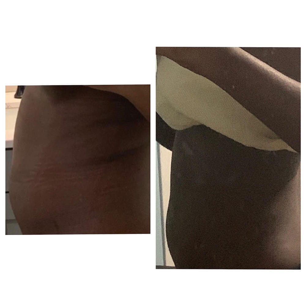 Customer photo review of Natural Fat Burner (3pk)