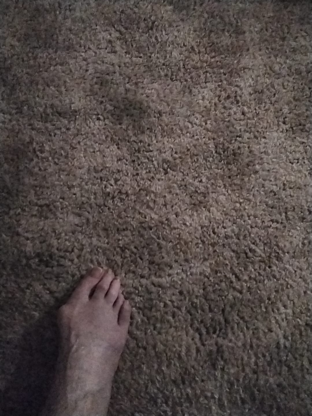 Customer photo review of Treatmedy™ Bunion Fix