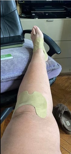 Customer photo review of Parches Naturales para Dolor de Rodillas Aliviate™