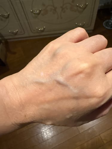 レビュー投稿者がHA-Lifting 35を使用した手の甲。シワが少なくなったことがわかるクローズアップです。