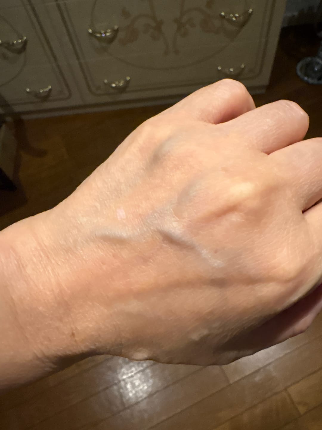 Customer photo review of HA-Lifting 35（ボトックスセラム）2本セット