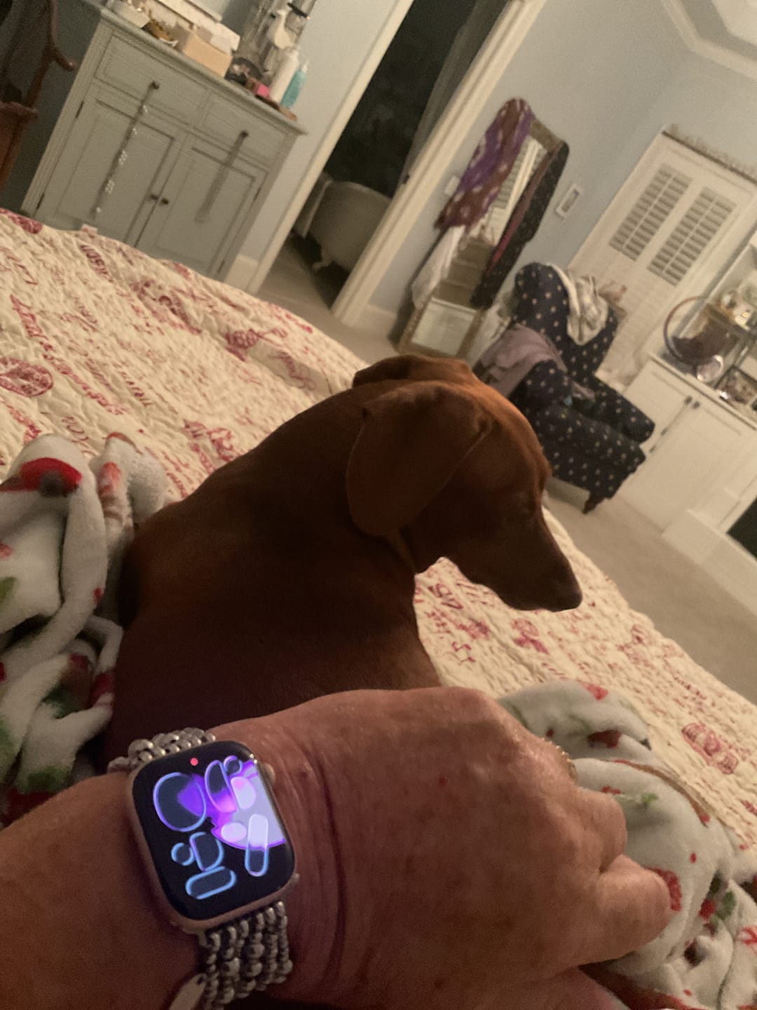 Customer photo review of Platinum Demure Stretch Apple Watch Strap