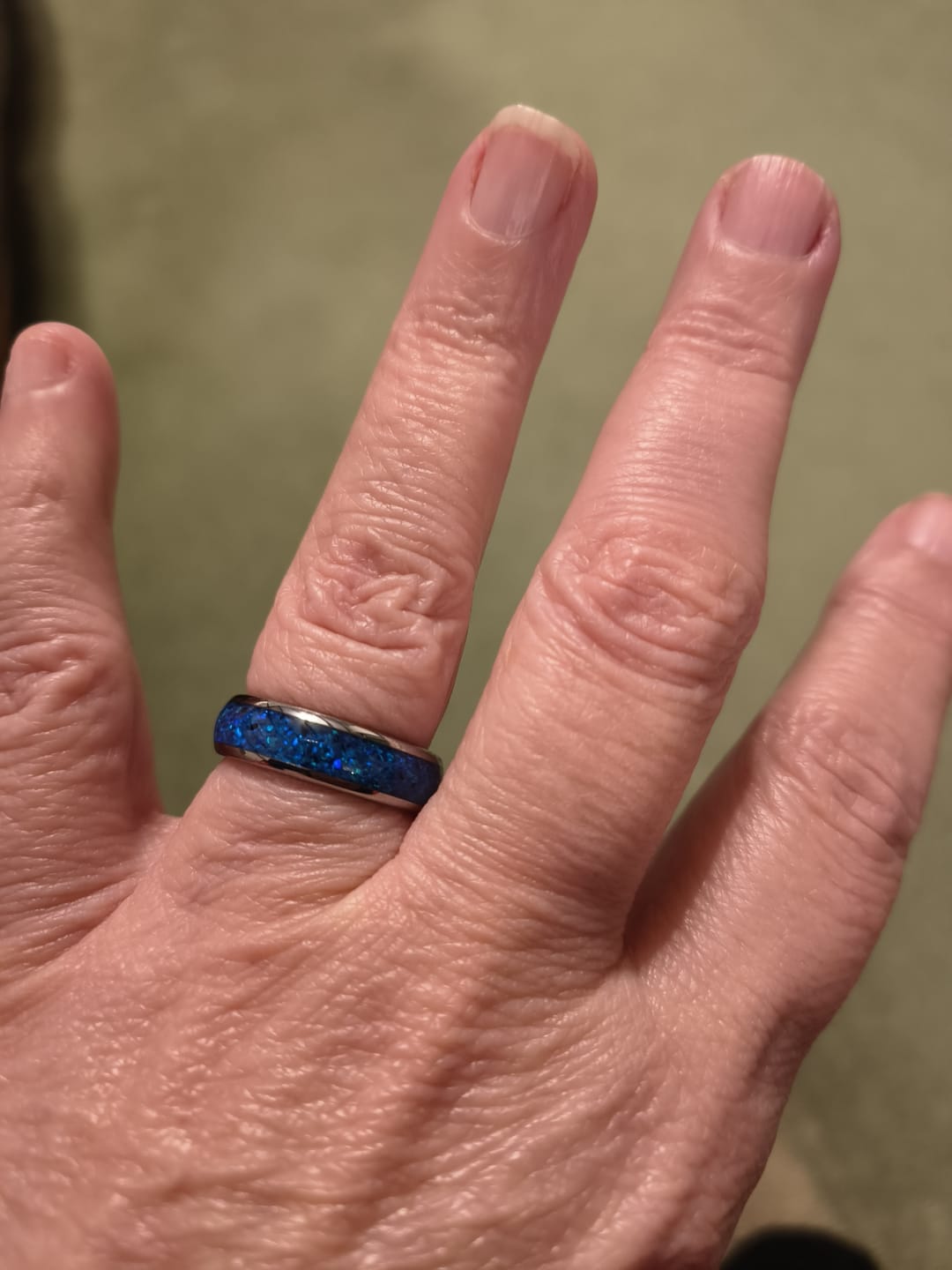 Customer photo review of The Blue Opal Wonder Ring Set