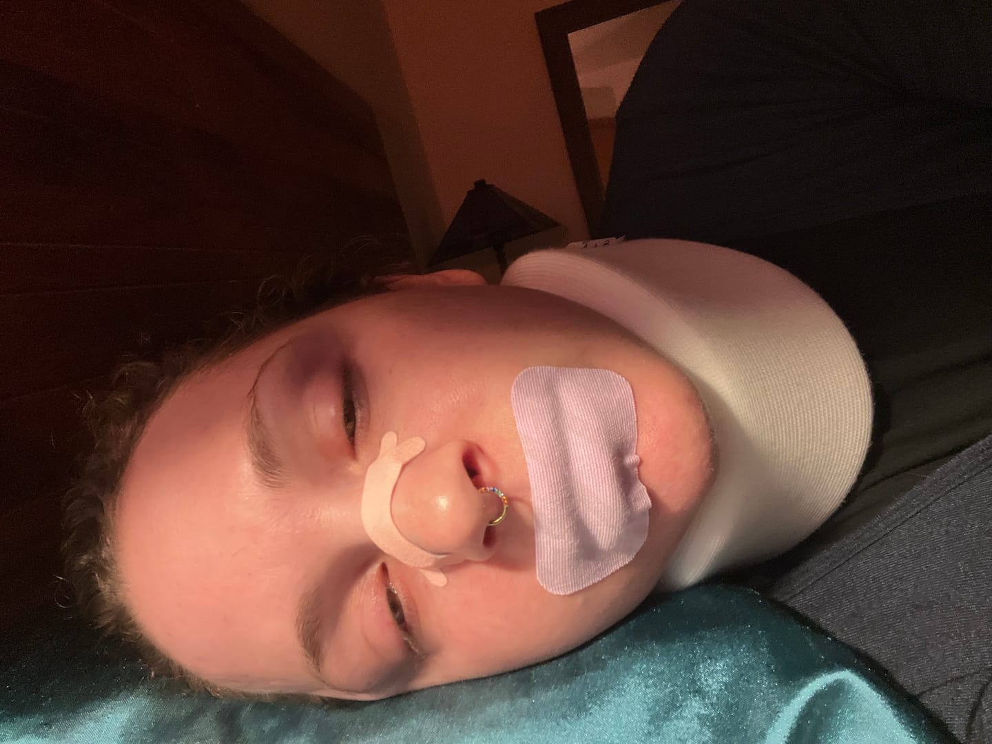 Customer photo review of ZzzTape - Mouth Tape