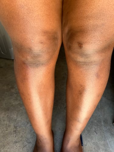 Customer photo review of Bright Skin Bish