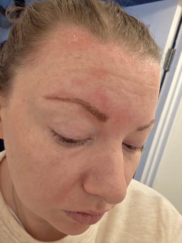 Customer photo review of Seb Natural Calming Serum