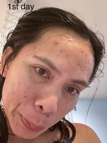 Customer photo review of JOANA'S SKIN SECRETS SOAP COLLECTION