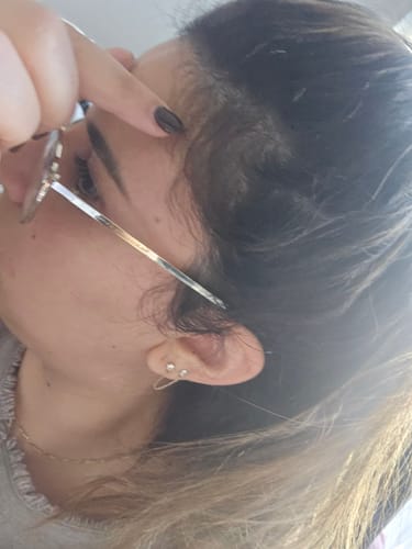 לקוחה מצביעה על צמיחת שיער חדשה בקו השיער לאחר שימוש ב-Fill it Women.