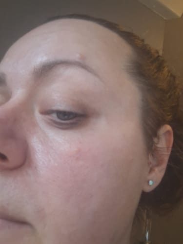 Customer photo review of Seb Natural Calming Serum