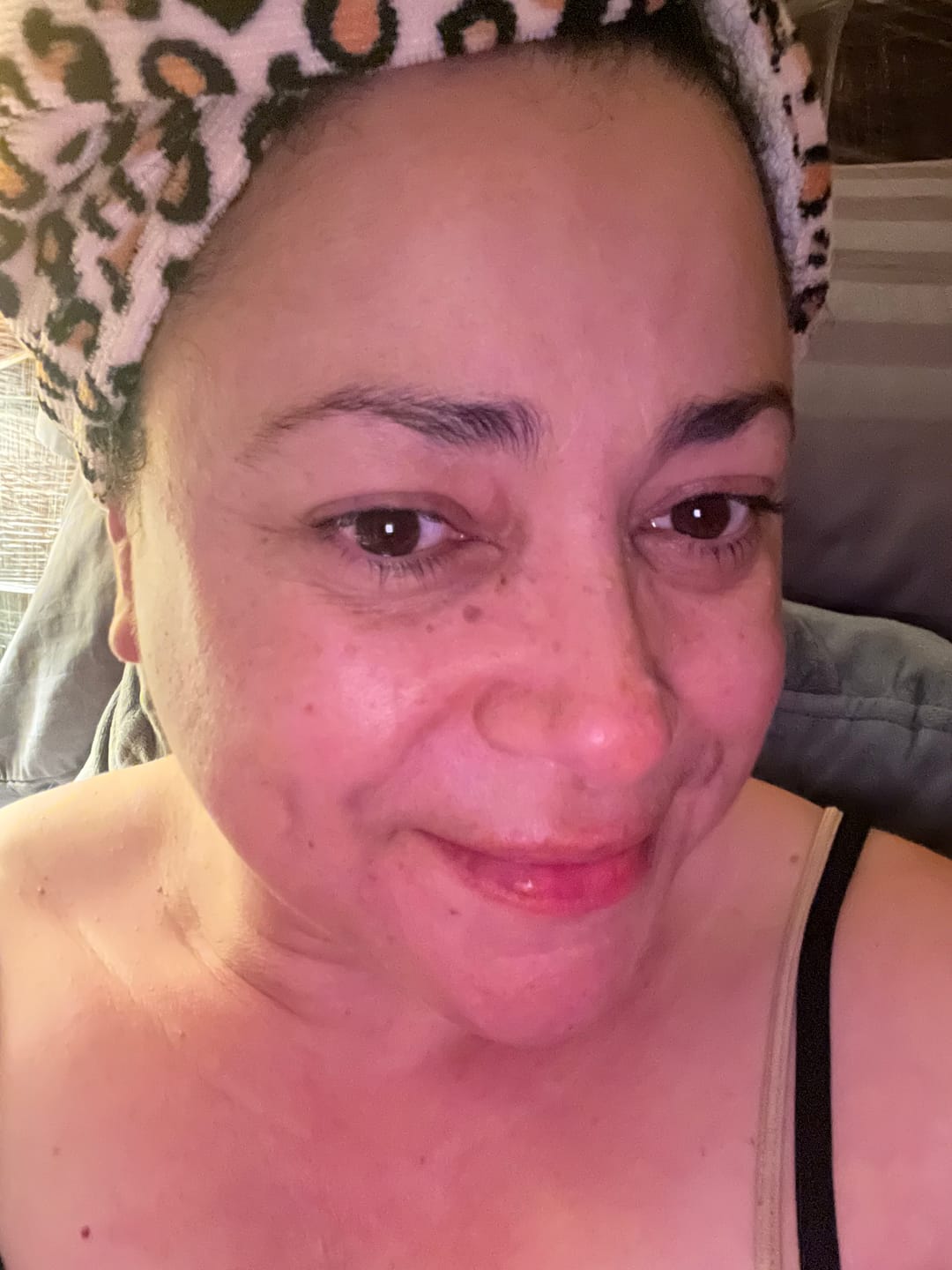 Customer photo review of Totemica Glow Kit - Special Edition