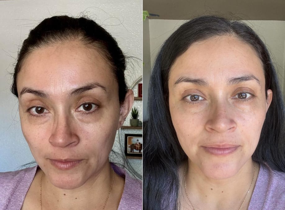 Customer photo review of INIA GLOW Eye Mask