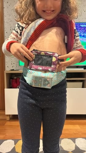 Customer photo review of Insulin Pump Waist Belt with Window for Children - Dia-Bellyband Mesh Window