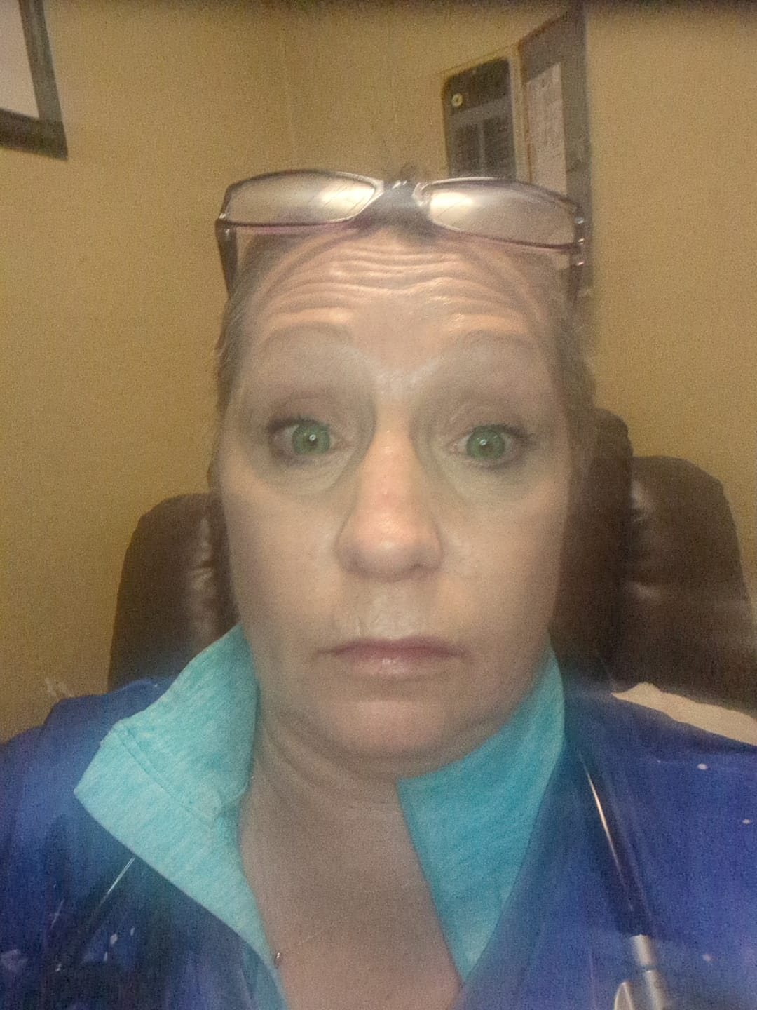 Customer photo review of Himalaya Green Prescription Coloured Contact Lenses