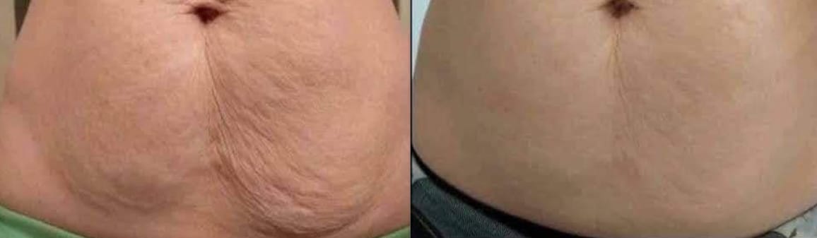 Customer photo review of Crème Raffermissante