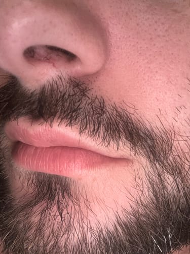 Customer photo review of Seb Natural Calming Serum