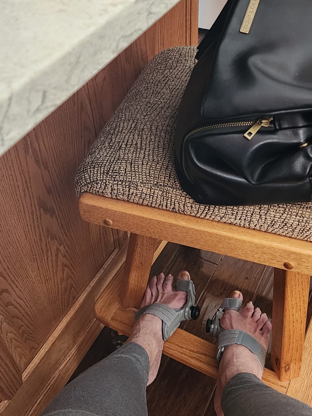 Customer photo review of Treatmedy™ Bunion Fix