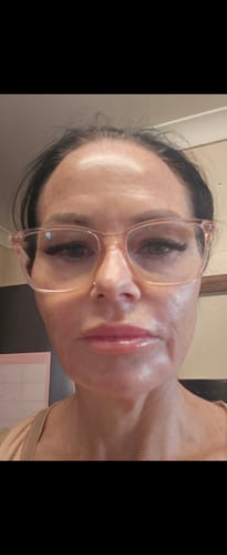Customer photo review of Biodance Bio-Collagen Real Deep Mask (4 Pieces)